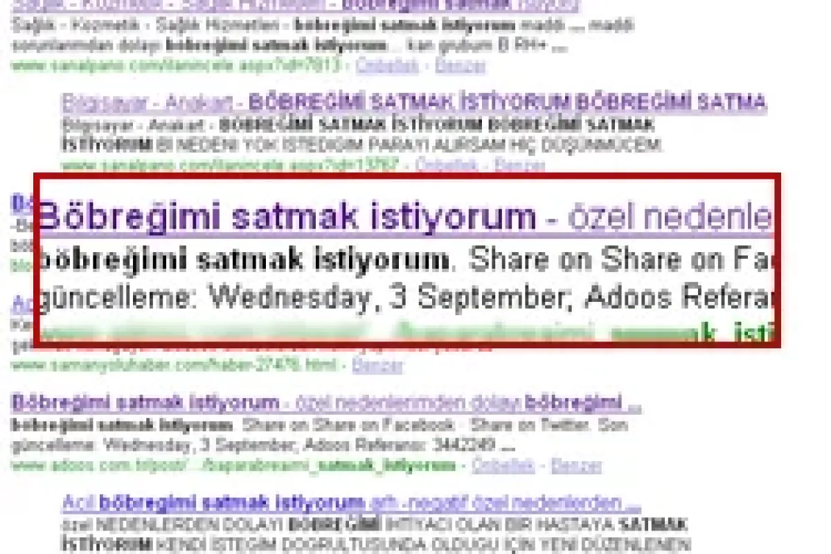 Türkiye organ ticareti cenneti