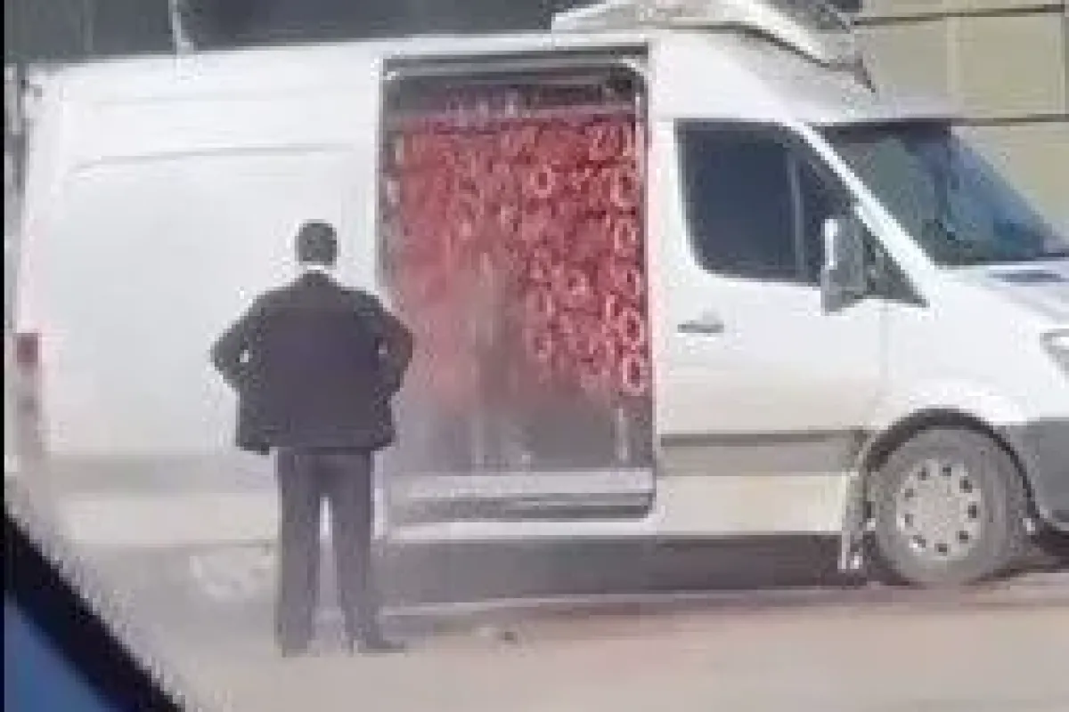 Mide görüntüler ortaya çıktı, iç dış sucuk yıkama