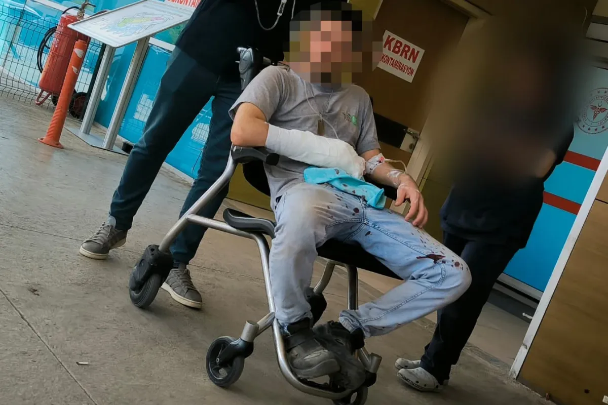 Mobilya Fabrikasında Genç İşçinin 2 Parmağı Koptu