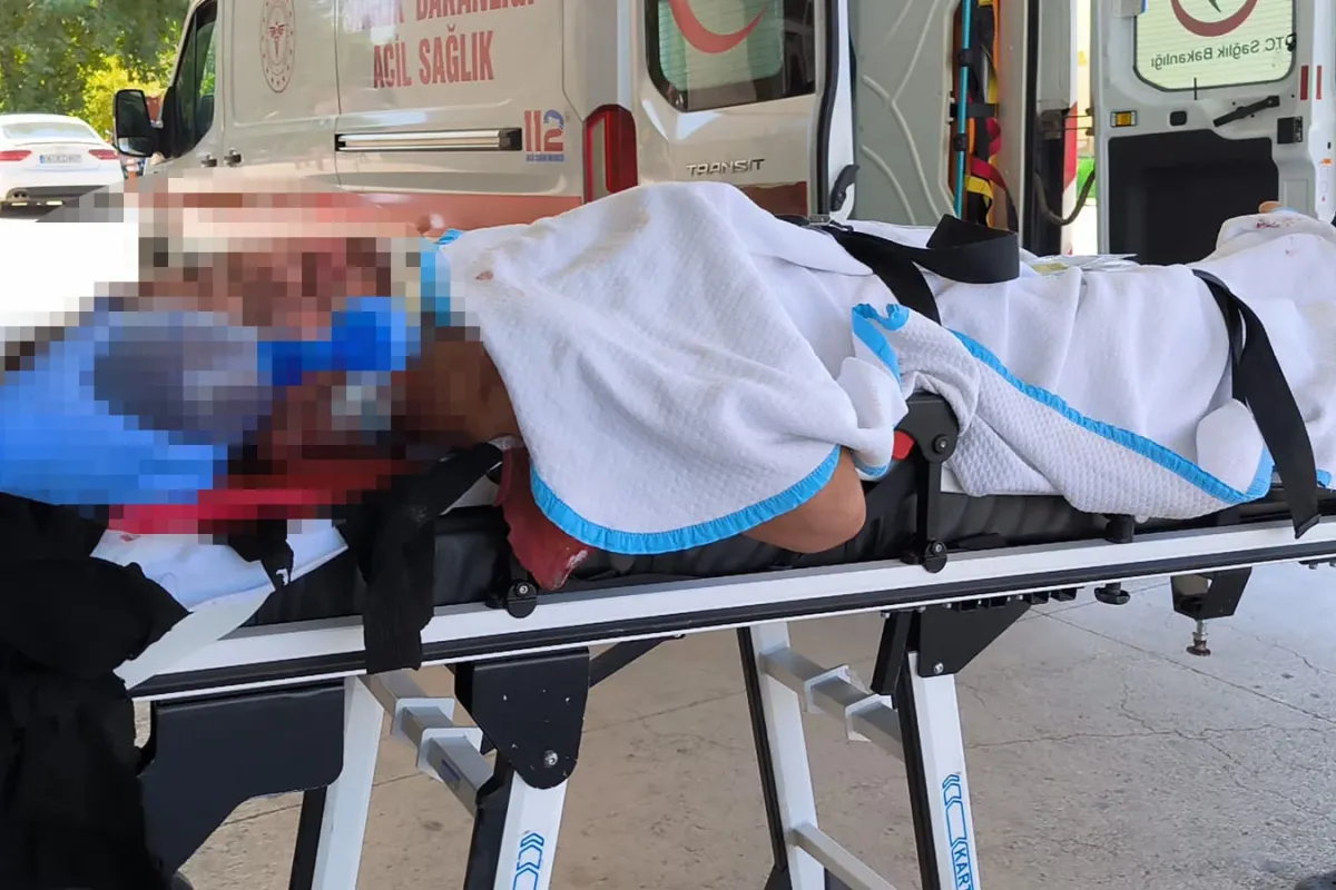 Bursa-Ankara Karayolunda Trafik Kazası: Motosiklet sürücüsü ağır yaralandı