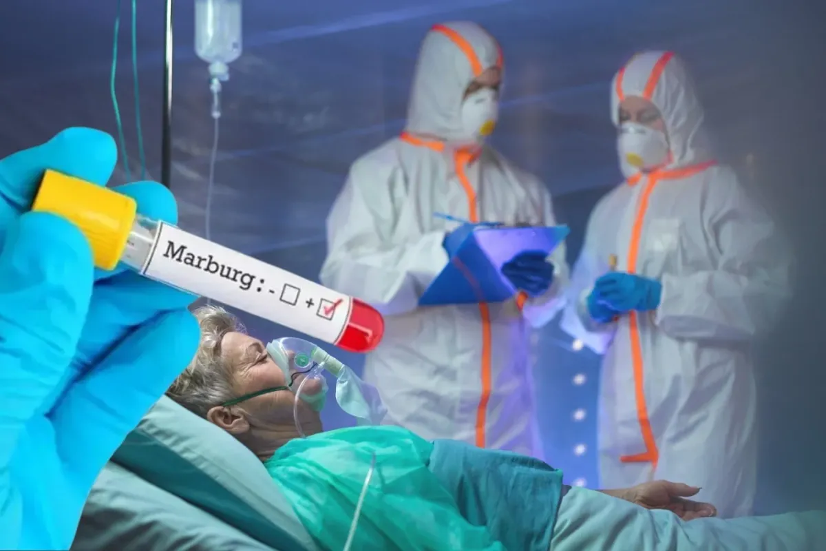 Marburg Virüsü Korkutuyor: Yüksek Ölüm Oranı ve Tedavi Eksikliği