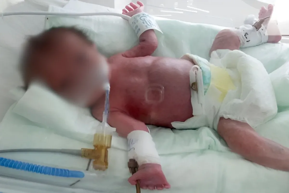 İkiz Bebeklerden Biri İhmaller Sonucu Hayatını Kaybetti
