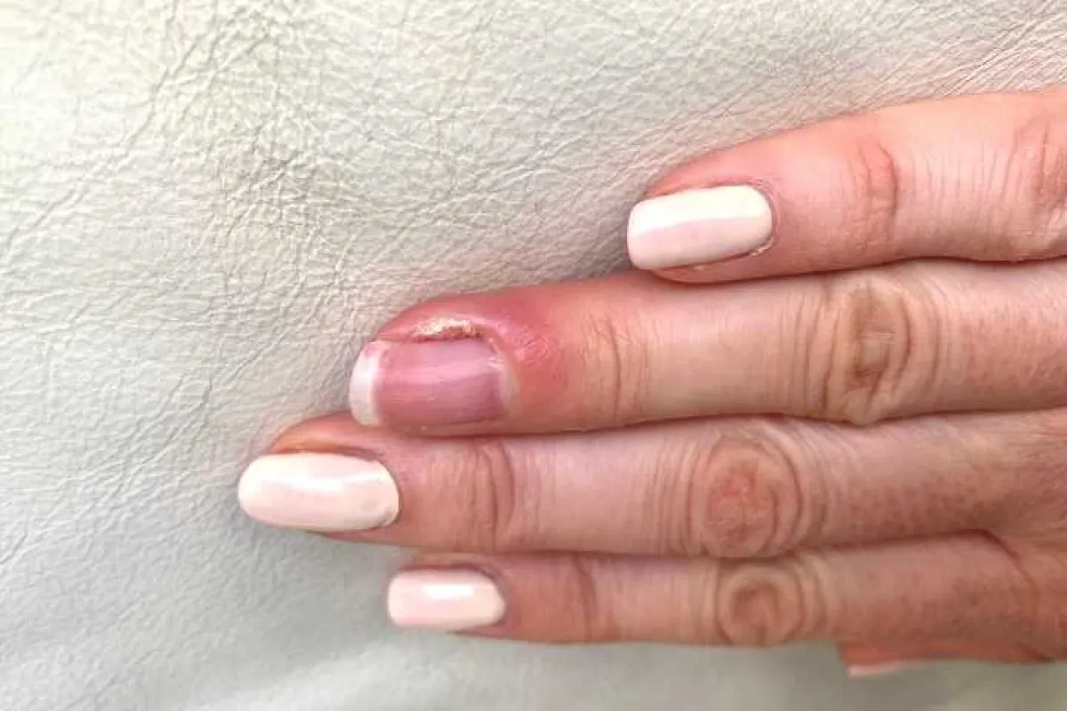 Parmakta Dolama Nazar Nedir? Türk Kültüründe Nazar Koruma Yöntemi