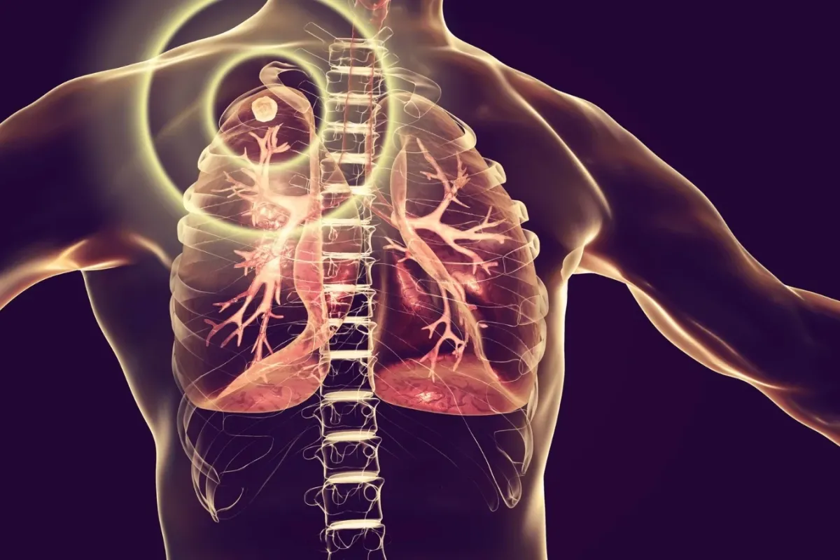 Türkiye'nin Veremle Mücadelede Örnek Başarısı!