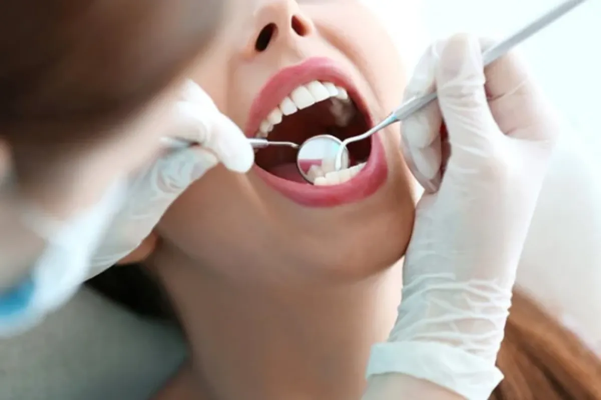 Diş İmplantı Nedir? Ne Kadar Süre Dayanır ve Kimlere Uygulanır?
