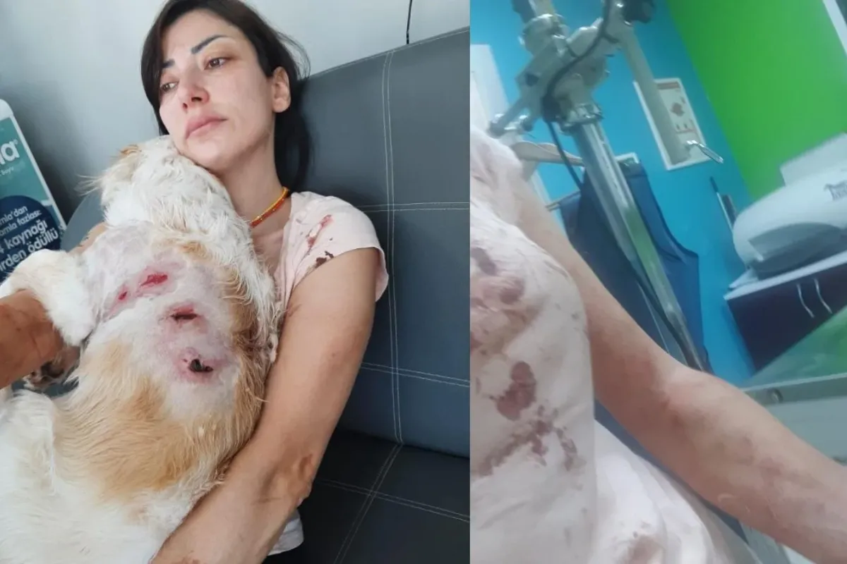 Köpeklerin saldırısından canını zor kurtardı