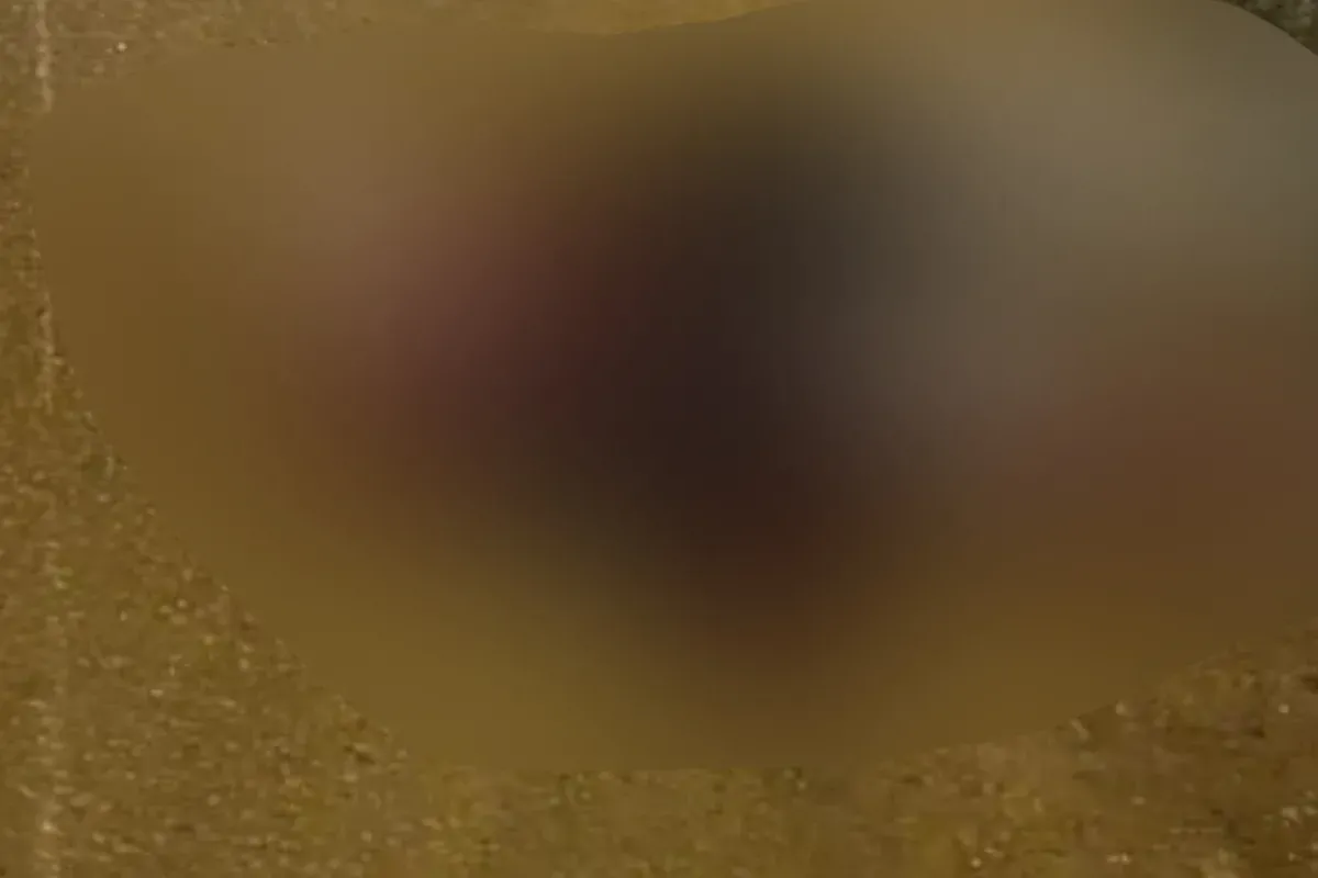 İnegöl'de kazada ağır yaralanan gençten acı haber geldi