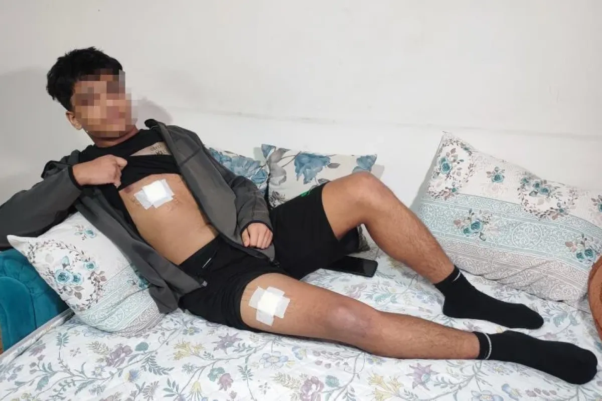 15 yaşındaki çocuk 3 yerinden bıçaklandı