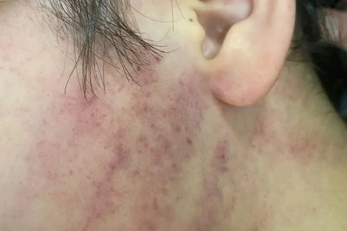 Konya'da veliler okula girip 2 çocuğu darp etti