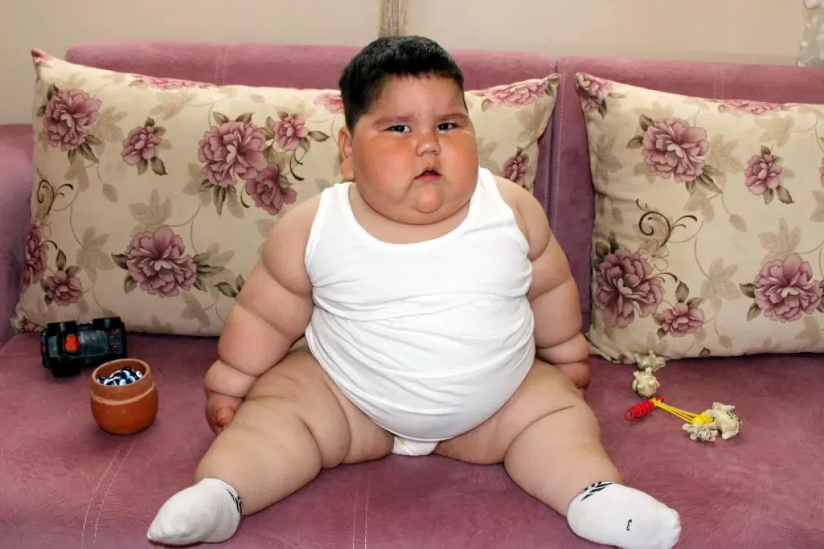 3 yaşındayken 55 kiloydu! Şimdiki hali ise bambaşka