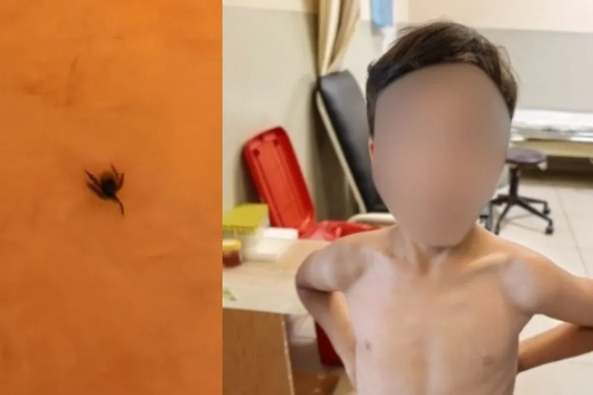 İnegöl'de kene alarmı! Hastaneye kaldırıldı