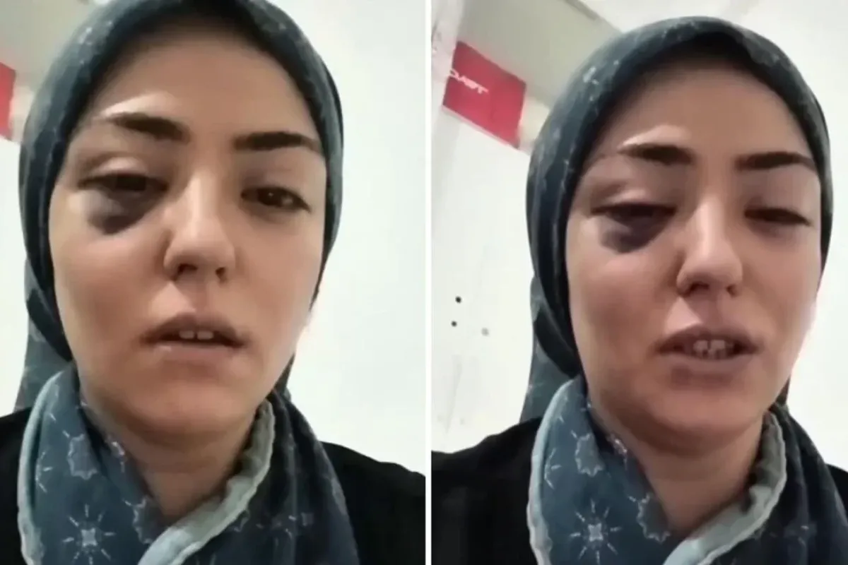 3 çocuk annesinin yardım çığlığı! "Beni kurtarın"