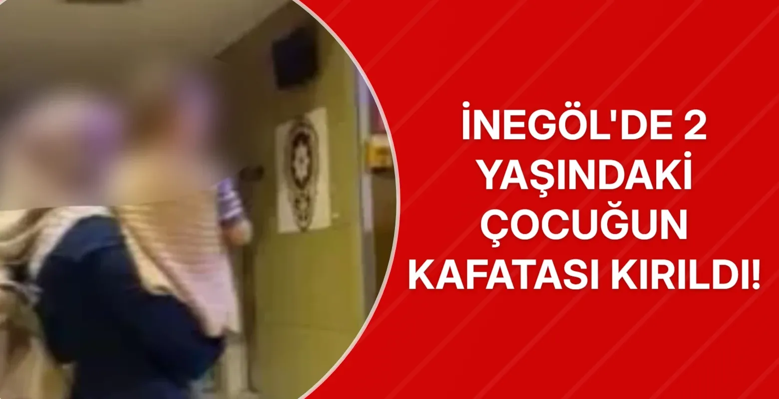 İnegöl'de 2 yaşındaki çocuğun kafatası kırıldı!