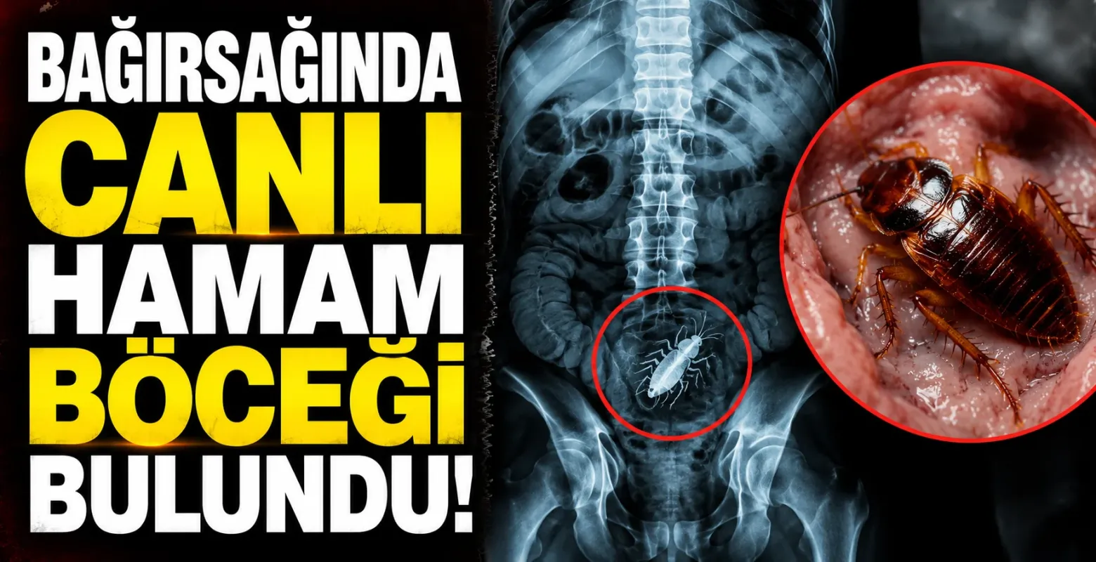 Bağırsağında canlı hamam böceği bulundu!
