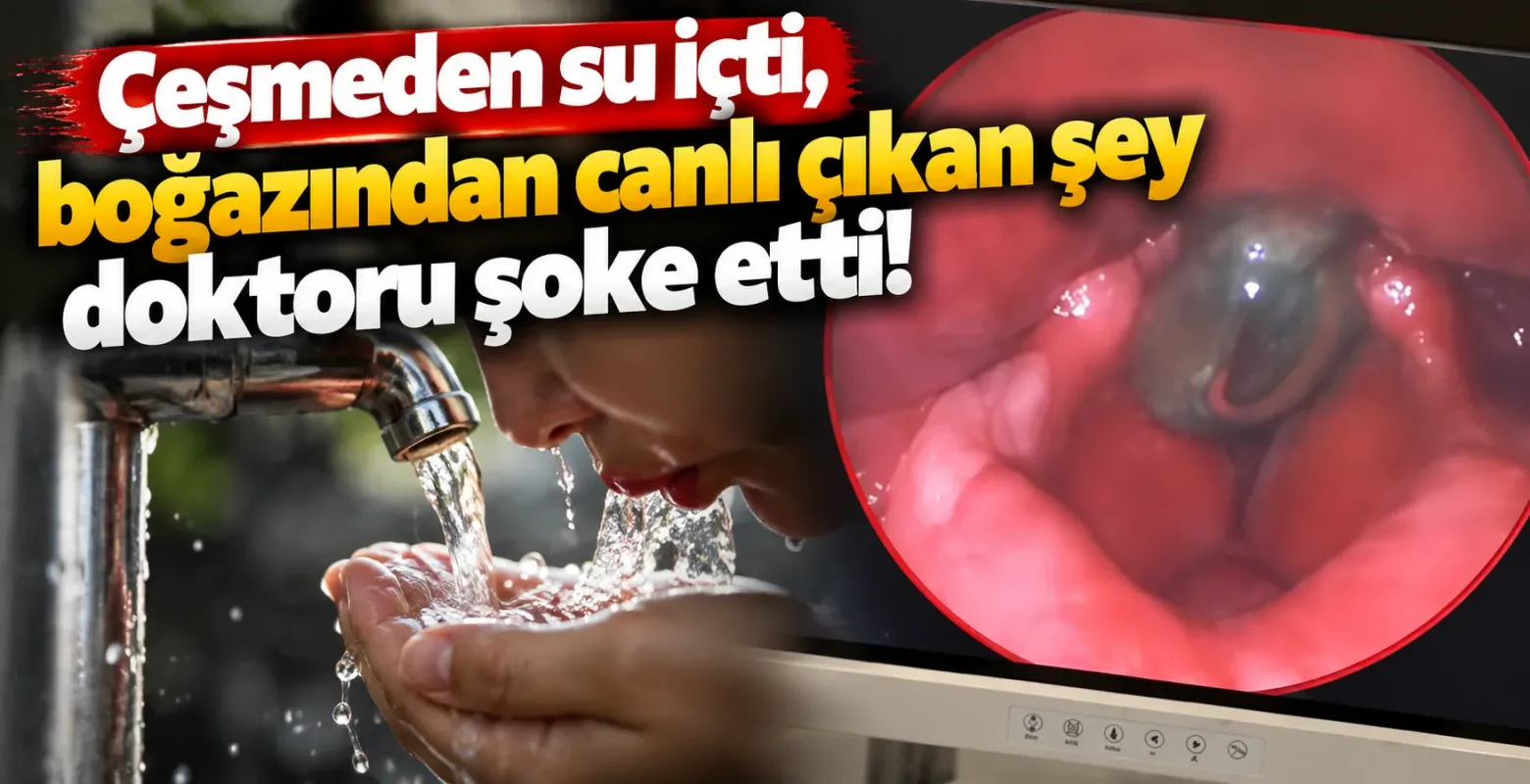 Çeşmeden su içti, boğazından canlı sülük çıktı!