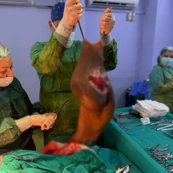 Karnından 40 kiloluk kitle çıktı, hayatı değişti