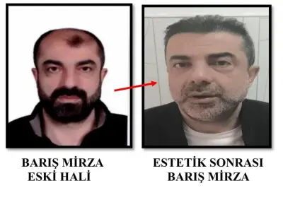 Ankara'da cinayet zanlısı yüz estetiğiyle tam 7 yıl saklandı!