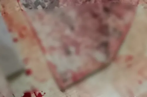 İnegöl'de Gece Yarısı Kanlı Olayı! 33 Yaşındaki Kişi Ağır Yaralandı