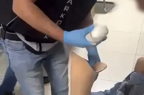 Protez bacağına sakladıkları sonunu getirdi!