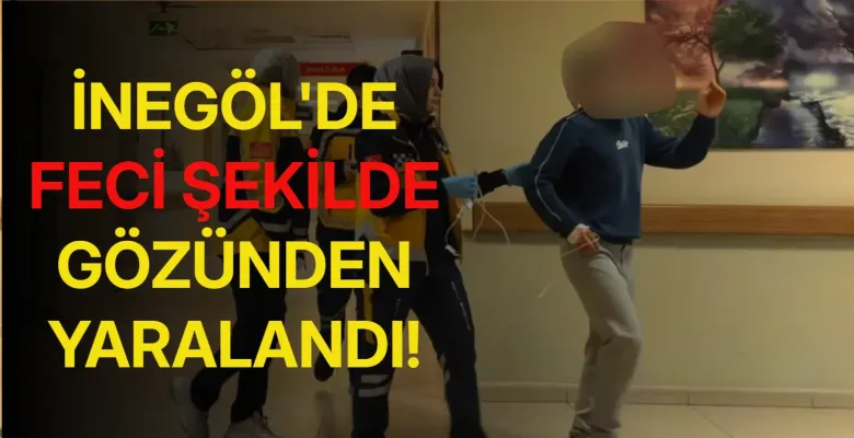 İnegöl'de feci şekilde gözünden yaralandı!