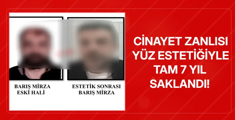 Ankara'da cinayet zanlısı yüz estetiğiyle tam 7 yıl saklandı!