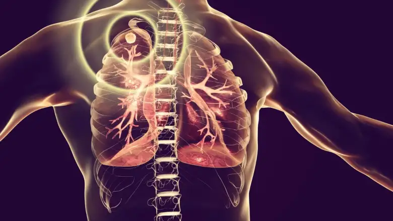 Türkiye'nin Veremle Mücadelede Örnek Başarısı!