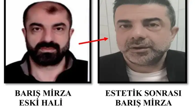 Ankara'da cinayet zanlısı yüz estetiğiyle tam 7 yıl saklandı!