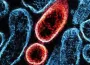Nipah virüsü nedir? Nasıl yayılıyor, ne kadar tehlikeli?