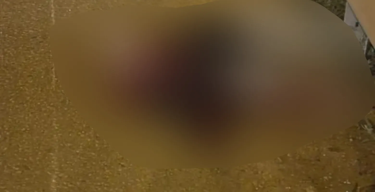 İnegöl'de kazada ağır yaralanan gençten acı haber geldi