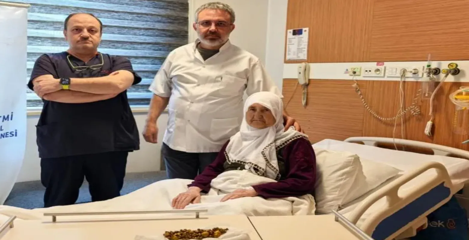 İnegöl'de yaşlı kadının safra kesesinde 200'ün üzerinde taş çıktı