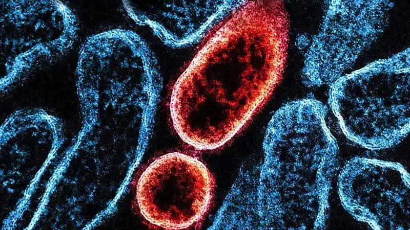 Nipah virüsü nedir? Nasıl yayılıyor, ne kadar tehlikeli?