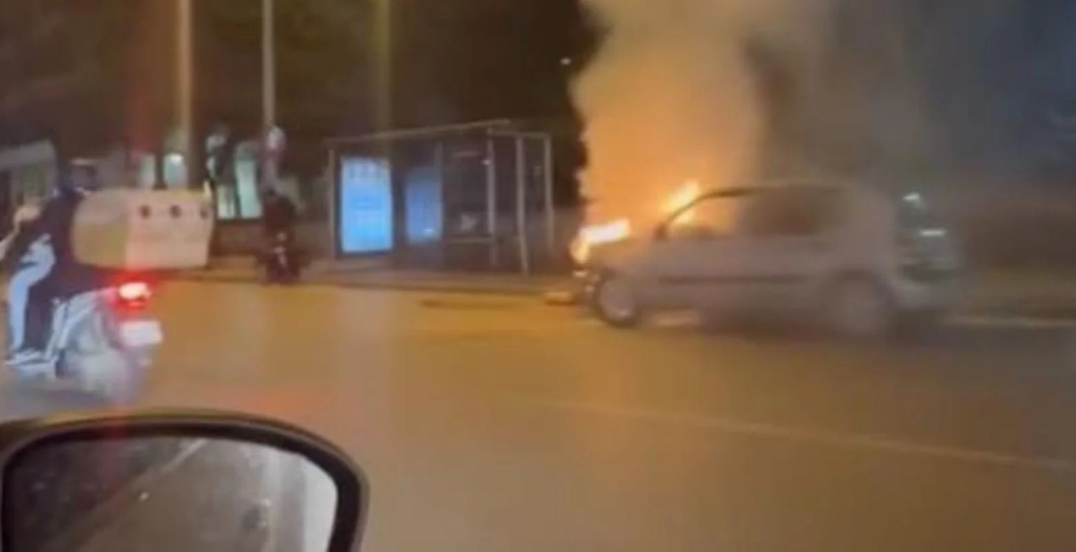 Cadde ortasında alevlere teslim oldu