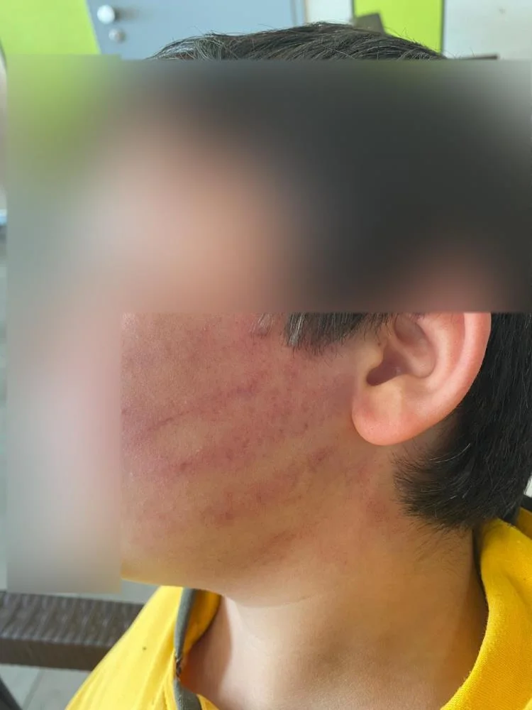 Konya'da veliler okula girip 2 çocuğu darp etti