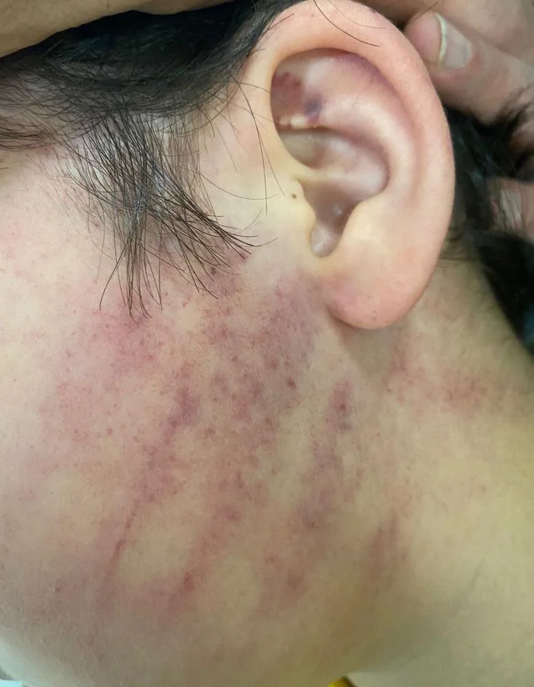 Konya'da veliler okula girip 2 çocuğu darp etti