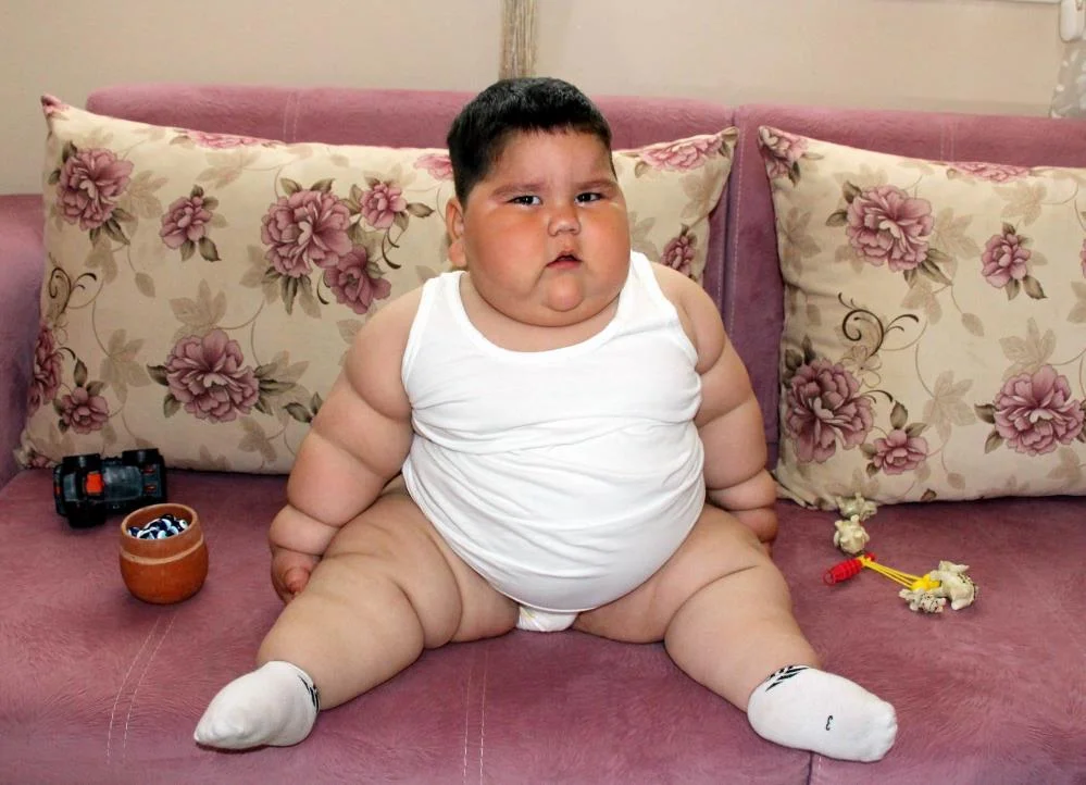 3 yaşındayken 55 kiloydu! Şimdiki hali ise bambaşka