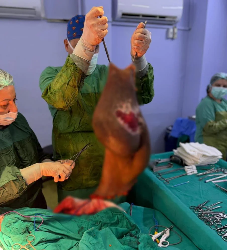 Karnından 40 kiloluk kitle çıktı, hayatı değişti
