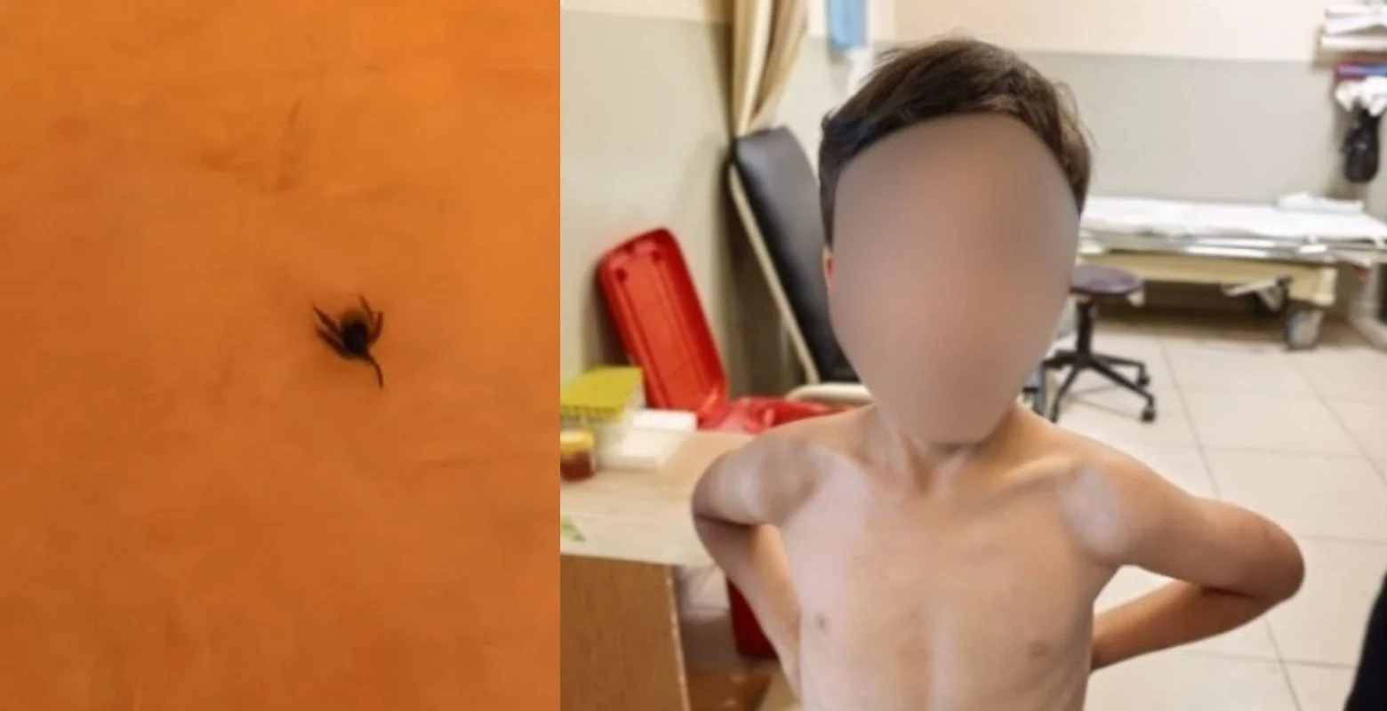 İnegöl'de kene alarmı! Hastaneye kaldırıldı